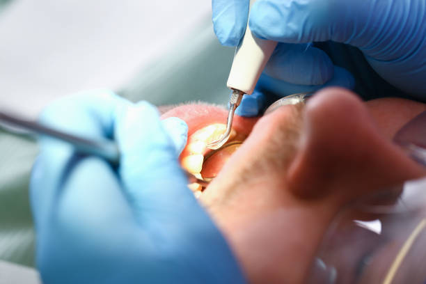 Best Emergency Dental Care for Broken or Chipped Teeth in Logan, UT