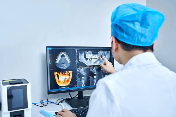 Best Emergency Wisdom Teeth Removal in Logan, UT